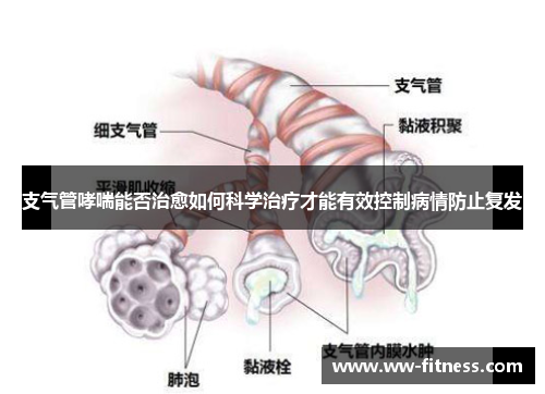 支气管哮喘能否治愈如何科学治疗才能有效控制病情防止复发