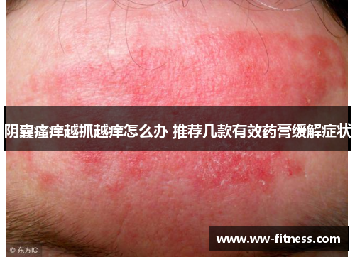 阴囊瘙痒越抓越痒怎么办 推荐几款有效药膏缓解症状